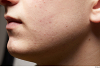  HD Face Skin Casey Schneider cheek chin face skin pores skin texture 0001.jpg